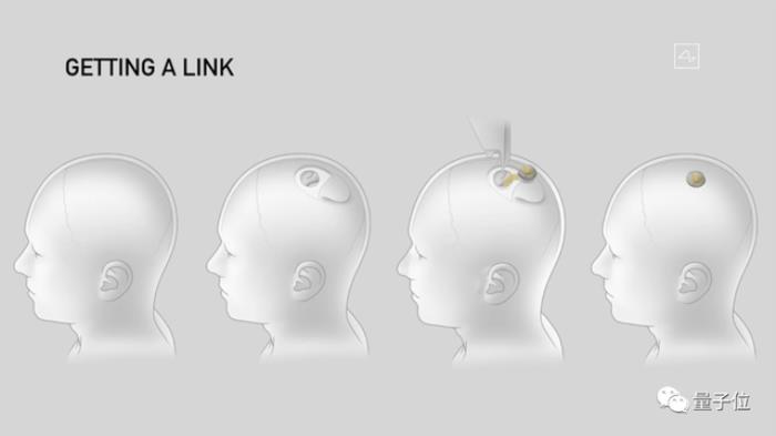 馬斯克最新芯片:腦機專用,讓失明人群“看見”