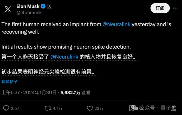 腦后插管玩《文明6》！馬斯克Neuralink首個(gè)人類患者，直播意念下象棋