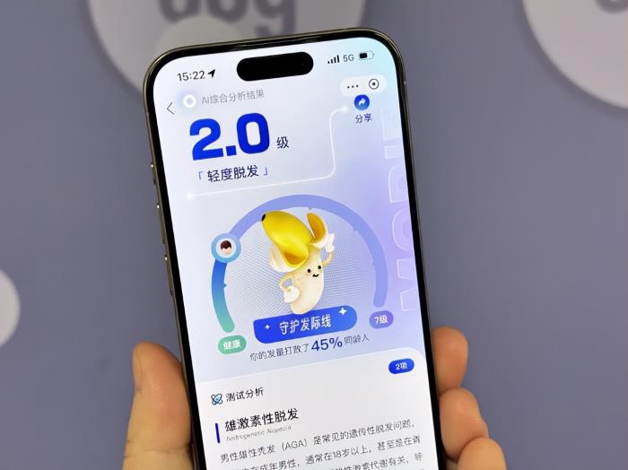 支付寶推出AI毛發(fā)自測(cè)工具，上傳照片即可自測(cè)脫發(fā)等級(jí)
