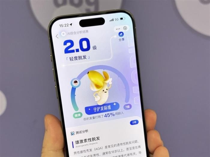 快去看你怎么禿的！支付寶推出AI毛發自測工具：幾張照片就能檢測