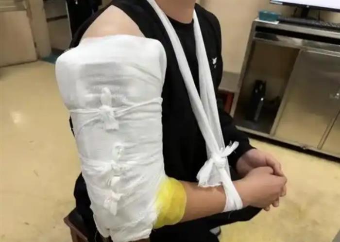倆小伙挑戰機器人“掰手腕” 結果兩人當場雙雙骨折