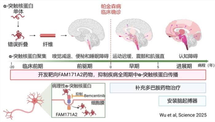 全球首次！復旦團隊發現帕金森全新治療靶點：AI大顯身手